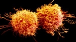 Celulas-cancerigenas-size-598